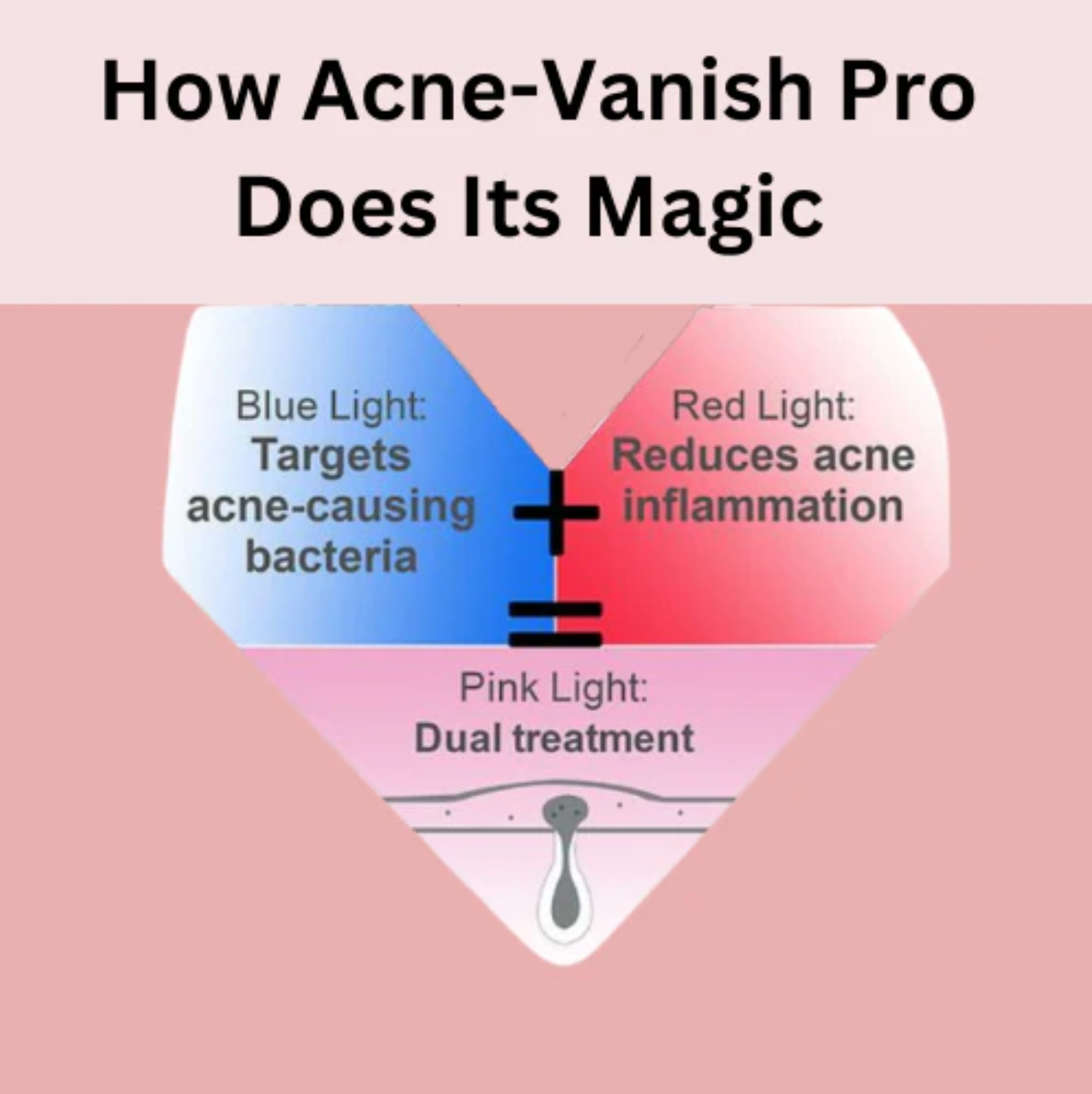 Acne-Vanish Pro™