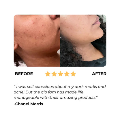 Kojic Acid & Turmeric Soap